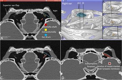 First photon-counting detector computed tomography in the living crocodile: a 3D-Imaging study with special reference to amphibious hearing 